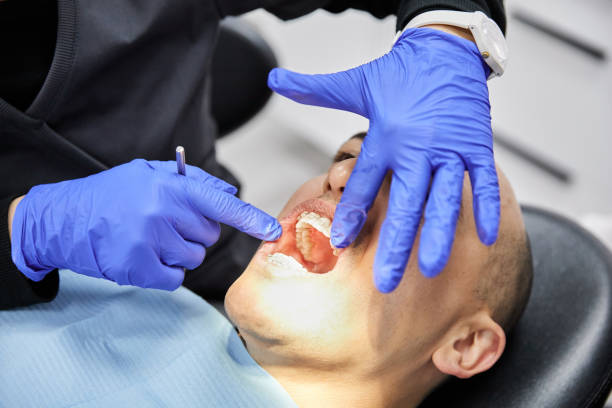 Best Dental Abscess Treatment in Cherokee, NC